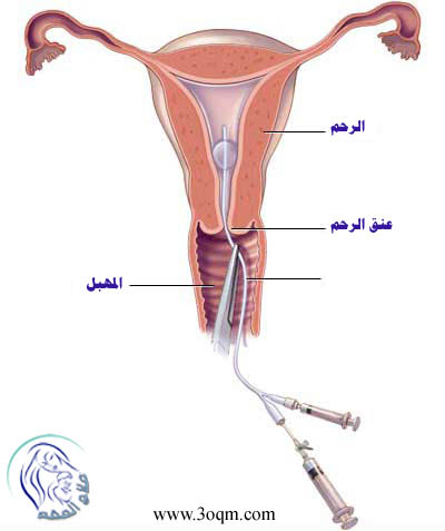 ����� ���� ����� �������