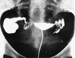 ���� ����� �������